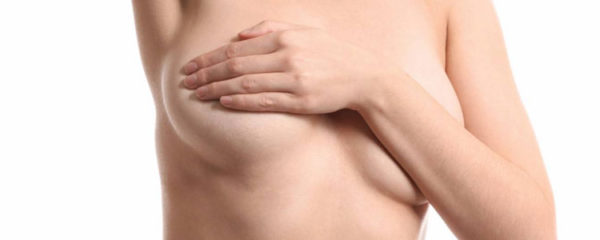 Cicatrices de réduction mammaire